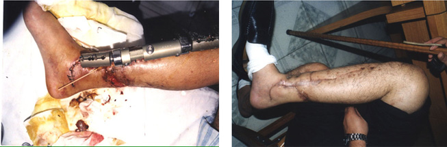 k8凯发(中国游)官方网站-APP下载